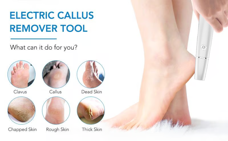 🔥Last Day Special Price £12.99!!💥-🎁Portable Electric Feet Callus Remover