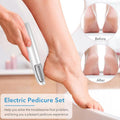 🔥Last Day Special Price £12.99!!💥-🎁Portable Electric Feet Callus Remover